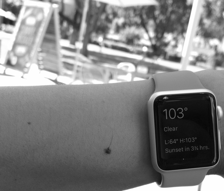 Apple Watch, hot or not?